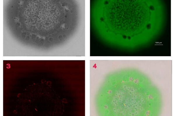 Imaging of biofilm using several methods
